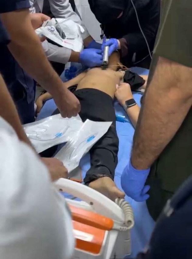 صعقة كهربائية أوقفت قلبه.. إنقاذ طفل بأعجوبة في النجف