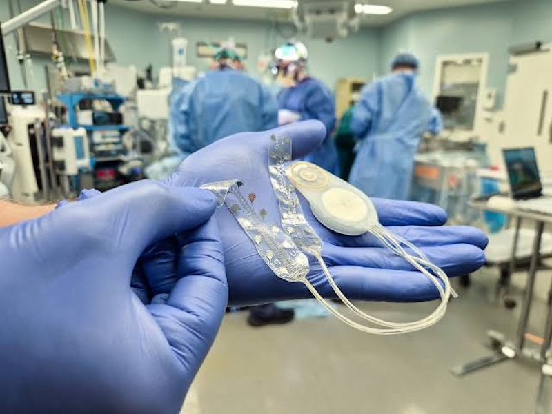 CorTec receives second FDA ‘Breakthrough Device’ designation for its brain computer interface