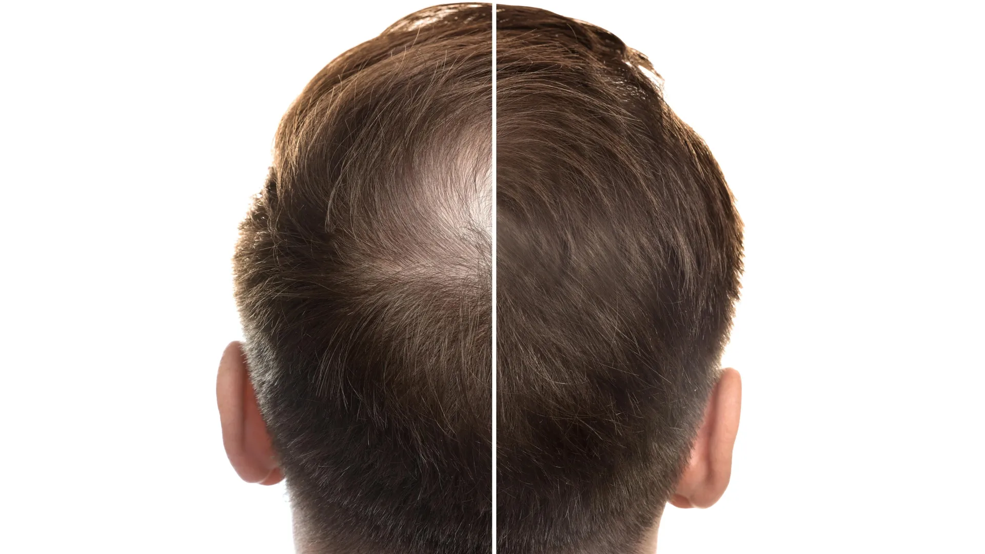 Ancient Chinese medicine could transform hair loss treatment